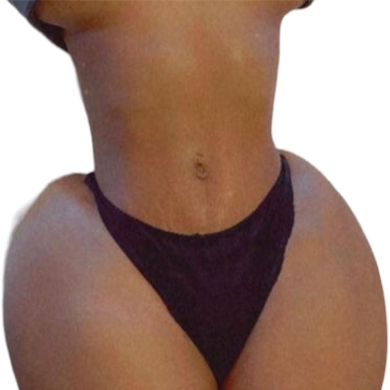 Na