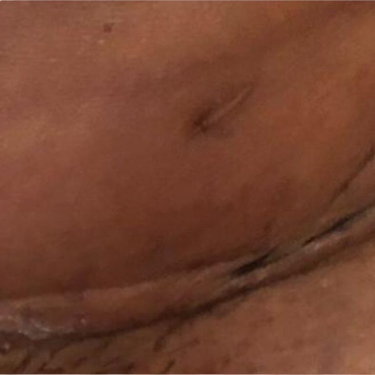 Voor