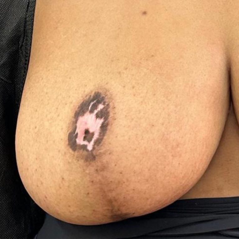 Voor